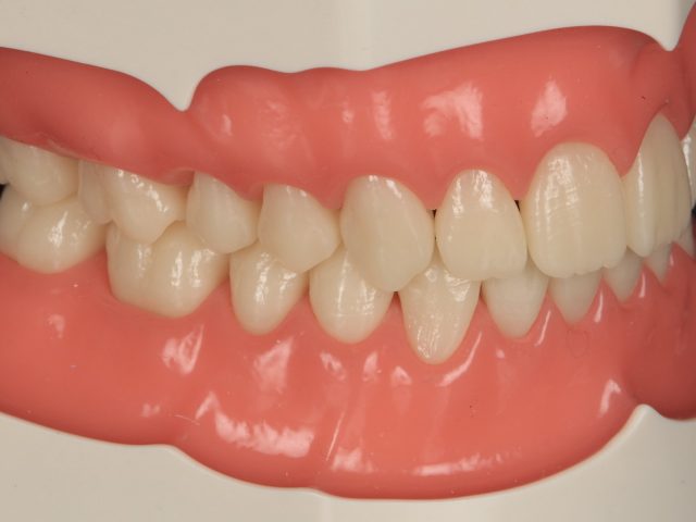 5 Large