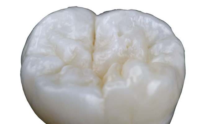 course-Direct-posterior-restoration-5
